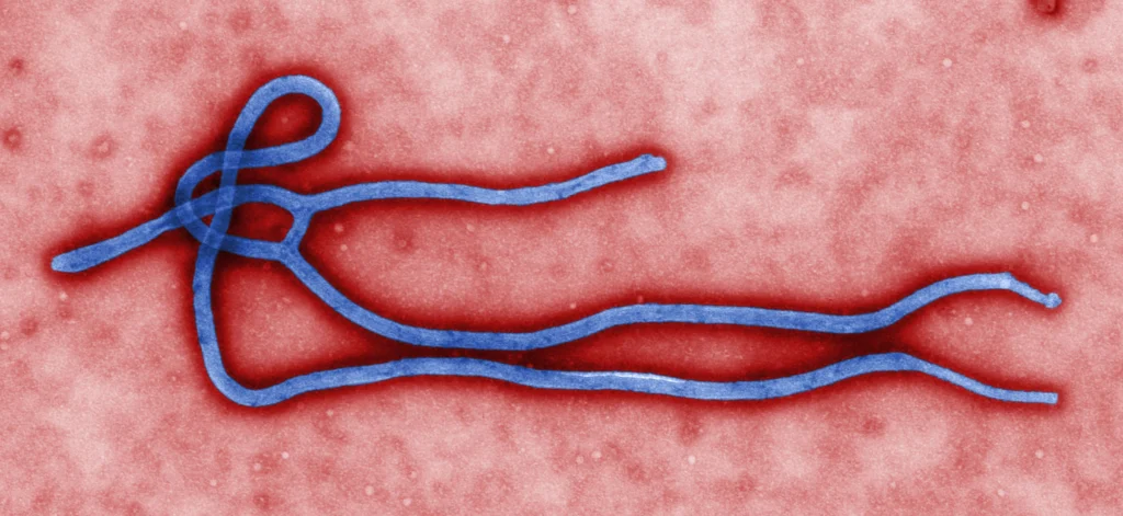 Micrographie électronique colorisée d’un virus Ebola, image d’illustration.